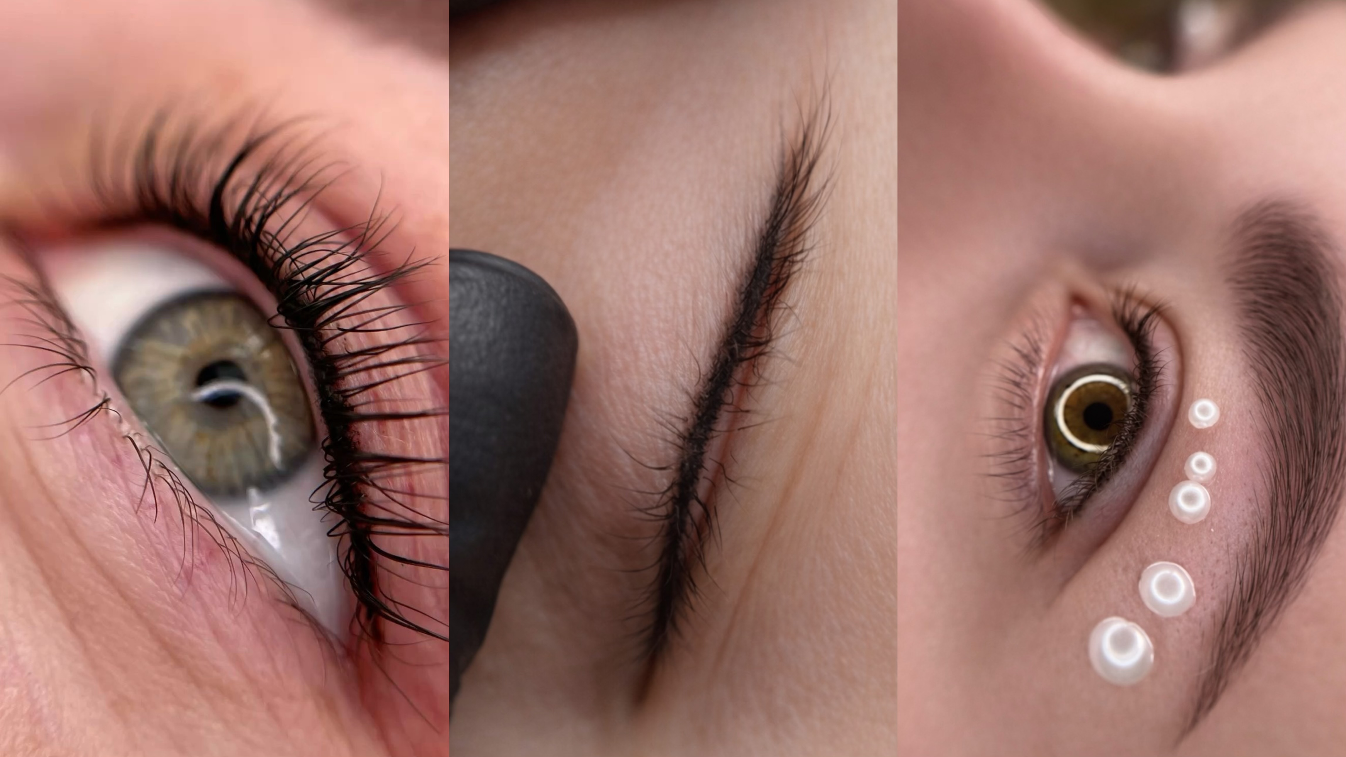 Wimpernkranzverdichtung